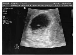2008-10-06 Ultrasound